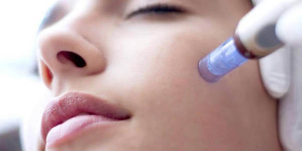 MICROneedling EN BOGOTA MICROneedling EN BOGOTA