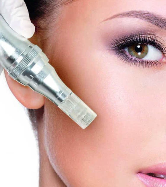 TRATAMIENTO DE MICRONEEDLING EN BOGOTA TRATAMIENTO DE MICRONEEDLING EN BOGOTA